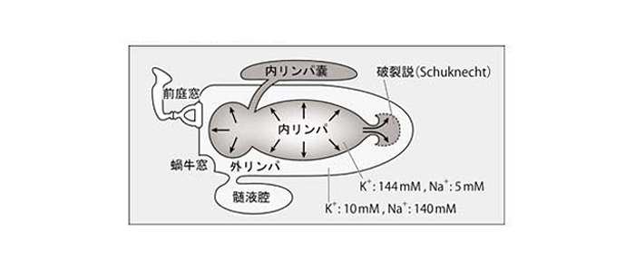 内リンパ水腫破裂説