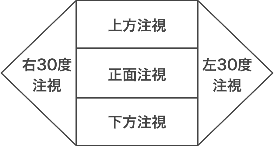 注視眼振記録