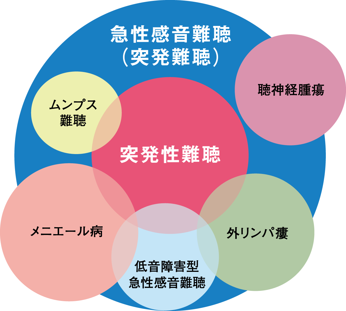 急性感音難聴（突発難聴）と突発性難聴の関係